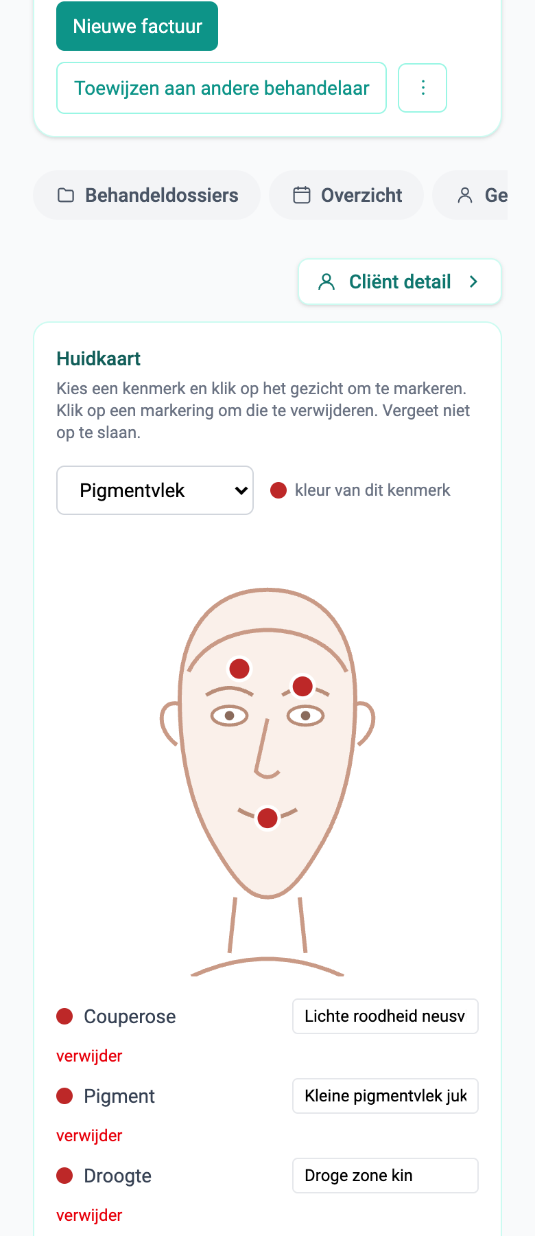Huidkaart (beauty)